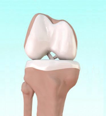 ACL and PCL Image