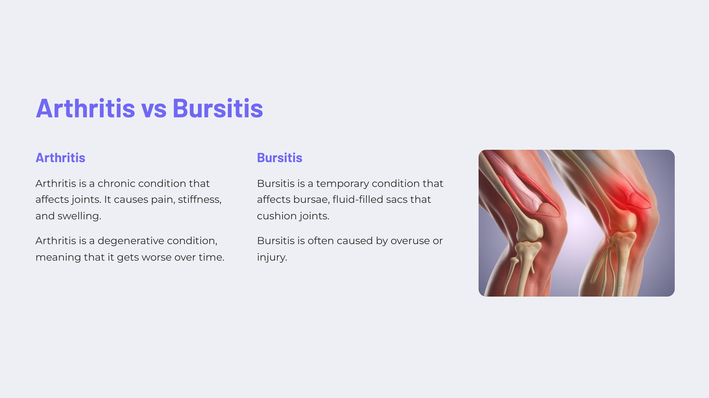 Arthritis-vs-Bursitis