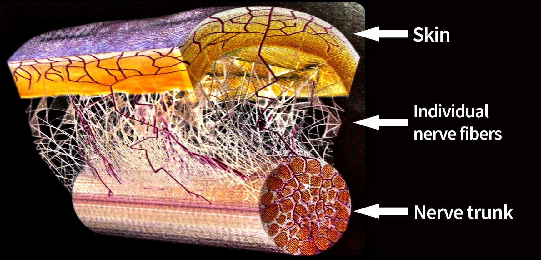 Perineural Injection Therapy Nerve Endings Illustration