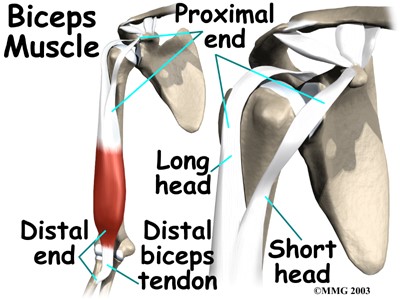 Proximal biceps tendon on sale rupture