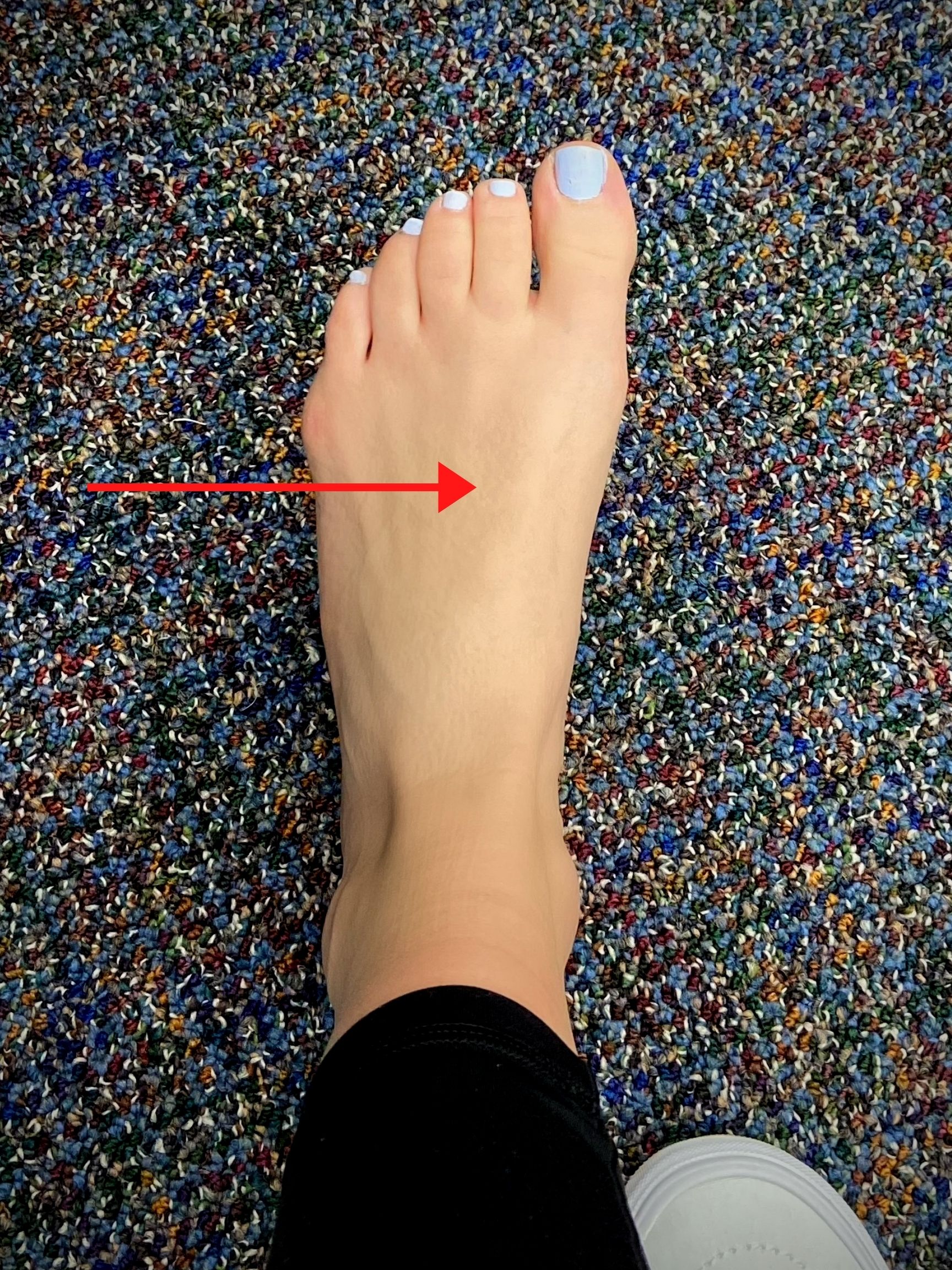 How To Tell if Your Foot Is Fractured - Heiden Orthopedics