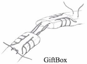 Giftbox - Achilles injuries