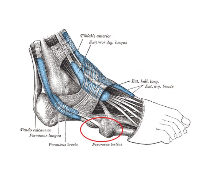 Does Your Foot Hurt Here? The Outside of the Foot