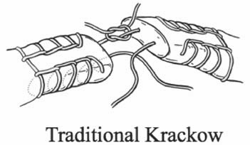 Krackow - Achilles injuries